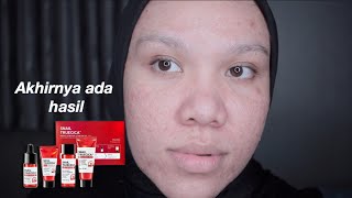 Download lagu Kelanjutan Snail Truecica & Cara penggunaannya mp3