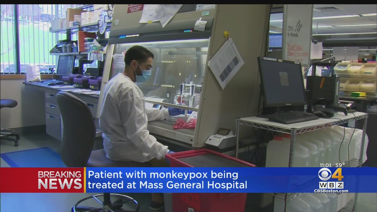 Patient with monkeypox being treated at Boston hospital