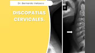 DISCOPATIAS CERVICALES CAUSAS SÍNTOMAS DATOS CLÍNICOS Y TRATAMIENTO