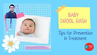 Drool Rash in babies | Tips on prevention and treatment