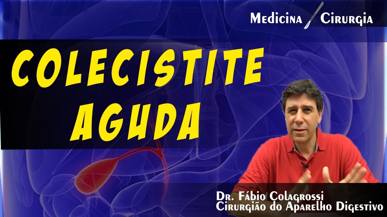 COLECISTITE AGUDA