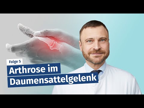 Arthrose im Daumensattelgelenk (Rhizarthrose)