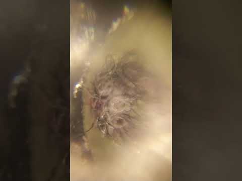 Watch till thing end and see what we're seeing