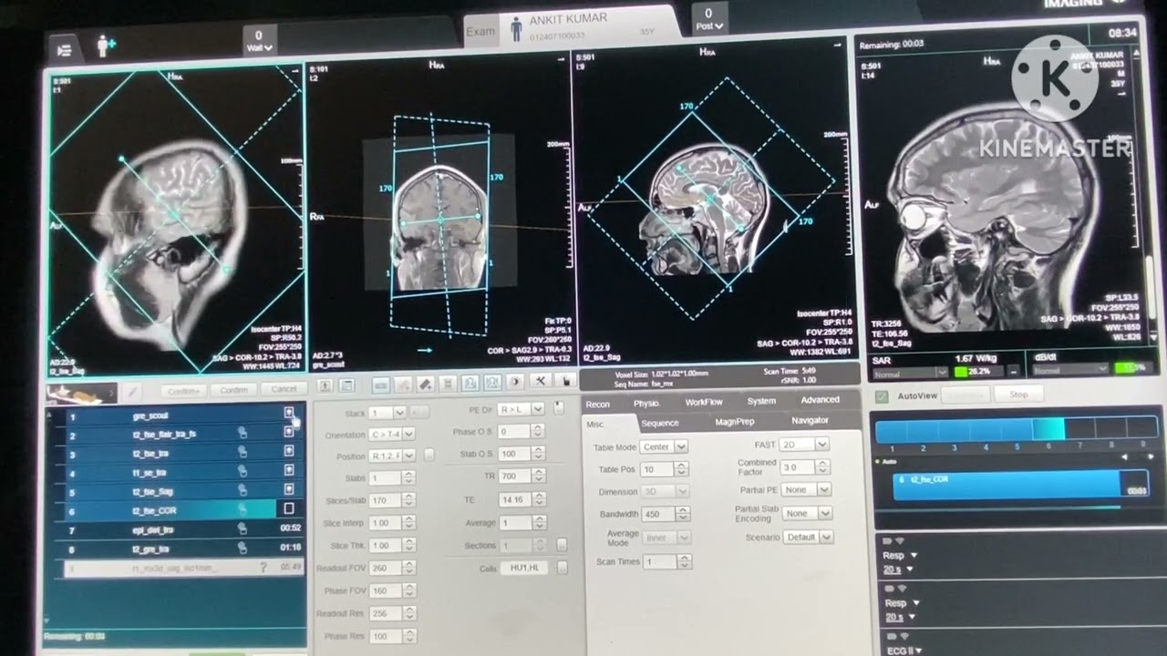 MRI BRAIN FULL PLANING & FILMING UNITED IMAGING MRI MACHINE
