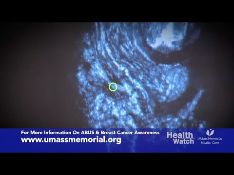 Health Watch: Automated Breast Ultrasound Screening