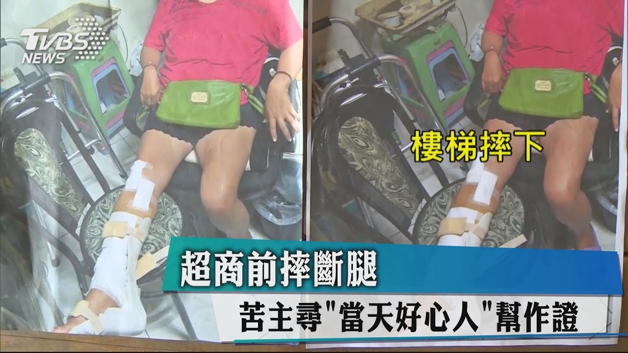 超商前摔斷腿 苦主尋「當天好心人」幫作證