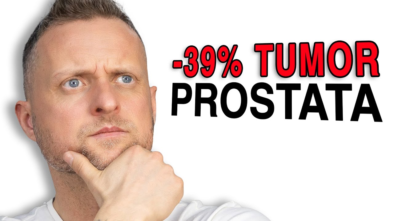 -39% Tumoraktivität: Dieser Stoff sagt Prostatakrebs den Kampf an! (Neue Studie)