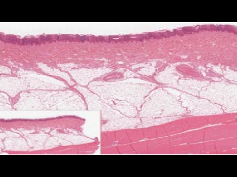 Anatomy and Physiology I Lesson 3: The Integumentary System