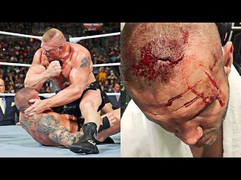 The Scariest Injuries In WWE History