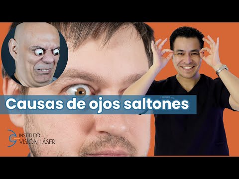 Causas de ojos saltones