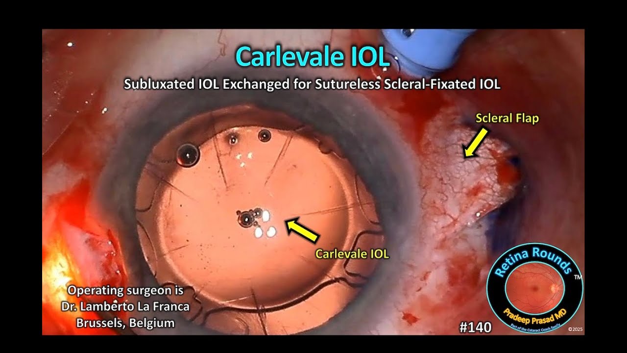 Lamberto La Franca-0