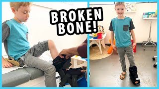 Jacob Broke His Foot