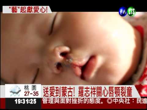 羅志祥關心唇顎裂童 挺癌童之家