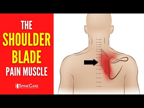 The Shoulder Blade Pain Muscle (How to Release It for INSTANT RELIEF)