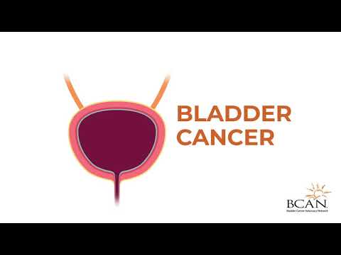 Video: What is bladder cancer? – Bladder Cancer Advocacy Network
