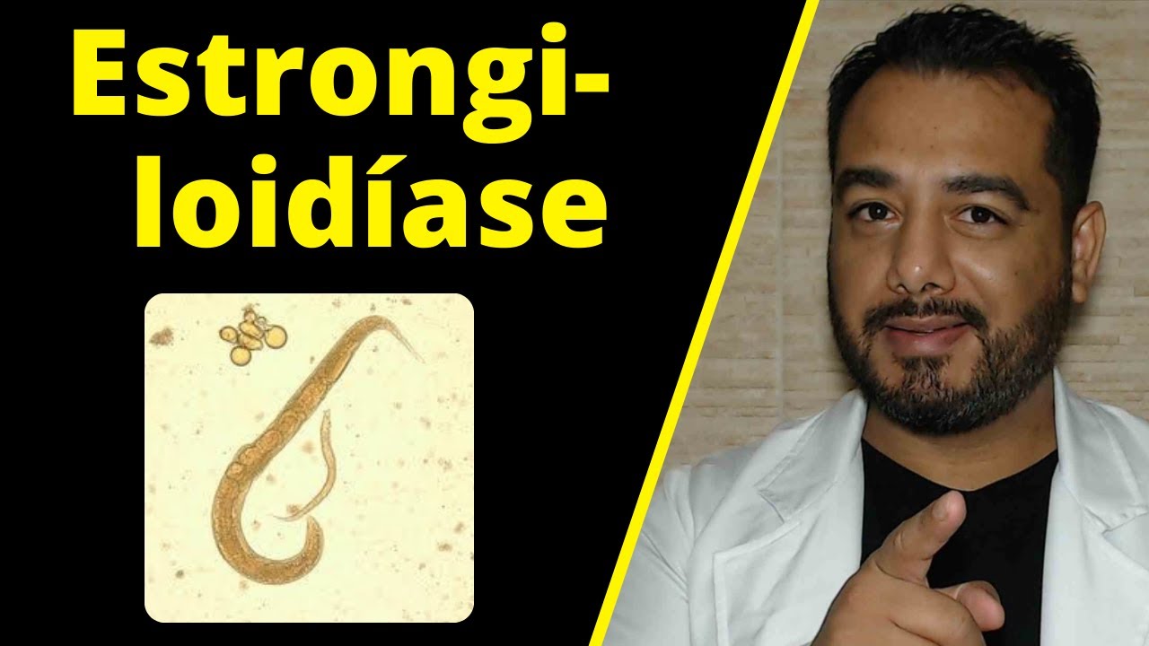 Estrongiloidíase (Strongyloides stercoralis) - Curso de Parasitologia Humana Básica e Clínica