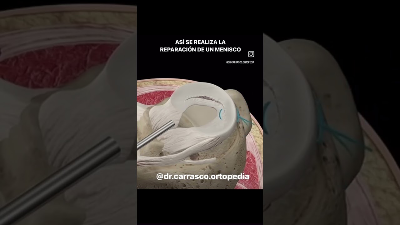 Vicente Carrasco García-30