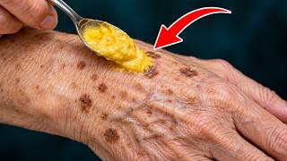 5 Simple Tricks to Fade Age Spots FAST 💥 (Super Easy) 🤯