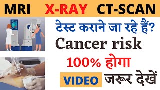 MRI, CT SCAN, X-RAY नुकसान पहुंचा सकता है कैंसर तक की हो सकता है by dr biswaroop roy choudhary