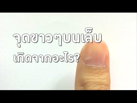 ผลิตภัณฑ์สีแดงสำหรับโรคสะเก็ดเงิน รูปภาพของโรคสะเก็ดเงินโฟกัส