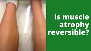 Is muscle atrophy reversible?