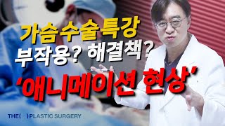 가슴성형수술 후 보형물이 움직이는 애니메이션현상은 부작용이 아니다?!