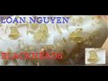 Blackheads Extraction And Whiteheads 198 Loan Nguyen