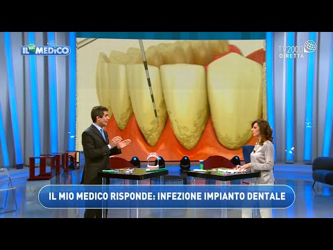 Salute dei denti: il mio medico risponde