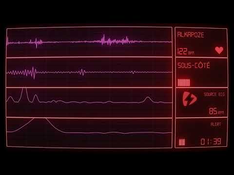 Alkapoze - Sous-Côté (Cover Video)