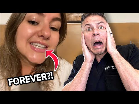Do You Need To Wear Your Retainer For Life? Orthodontist Reacts!