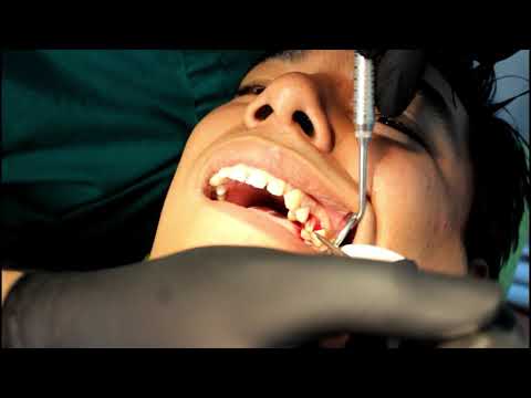 download lagu mp3 mp4 Muela Cariada, download lagu Muela Cariada gratis, unduh video klip Muela Cariada