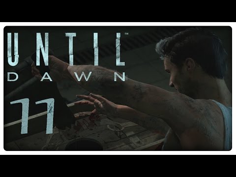 UNTIL DAWN 💀 #11: Snip, snap, finger off?!