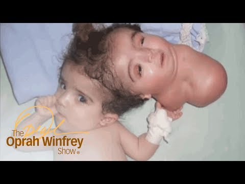 , title : 'The 2-Headed Baby Miracle | The Oprah Winfrey Show | Oprah Winfrey Network'