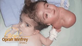 The 2-Headed Baby Miracle | The Oprah Winfrey Show | Oprah Winfrey Network video
