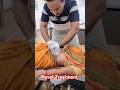 Navel Displacment Treatment Chiropratic Gas Acidity Asmr Physiotherapy Backpain Chiroprectic