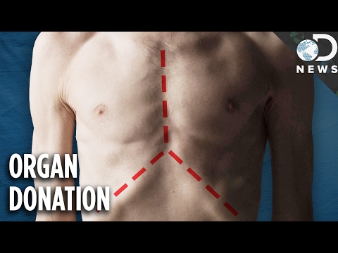 What Actually Happens To Your Body When You Donate Your Organs?