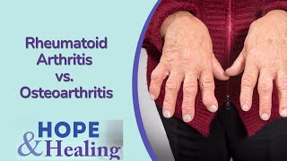 Rheumatoid Arthritis vs. Osteoarthritis | Treating Hand Pain Town Hall