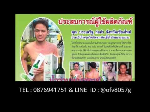 โรคสะเก็ดเงินบนเล็บติดต่อ Betasalitsilik ในโรคสะเก็ดเงิน