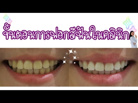 ขั้นตอน