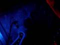 circo- duele