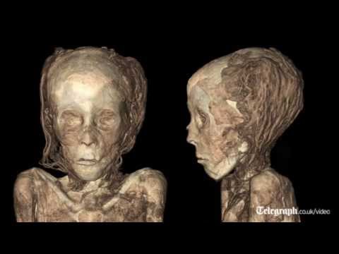 esercizi per la prostatite julio de
