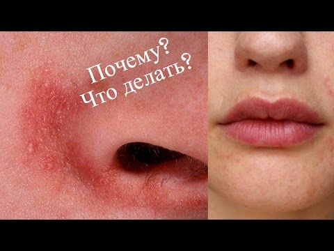 Бадяга от пигментных пятен как пользоваться Отбеливающий крем от нивея