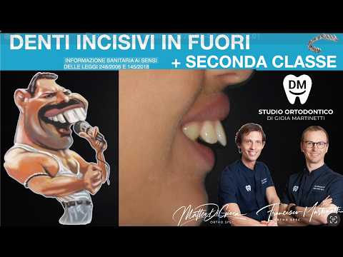 Matteo Di Gioia-20