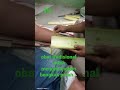 Obat Tradisional Menghilangkan Bengkak Yg Parah Langsung Kempees