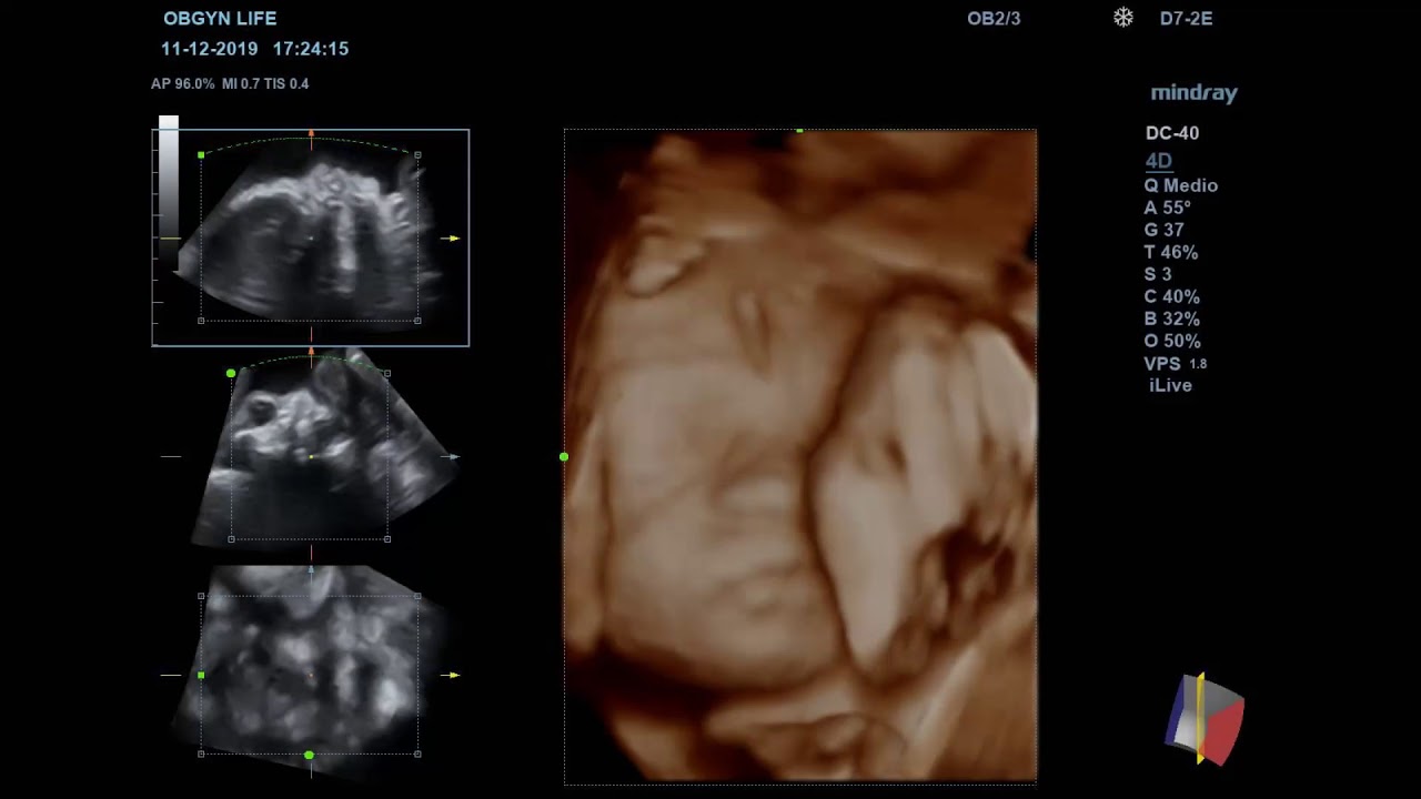 Mario Enrique Cardona Osuna-13