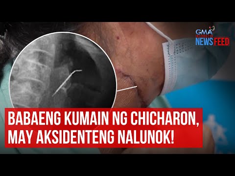 Babaeng kumain ng chicharon, may aksidenteng nalunok! GMA Integrated Newsfeed