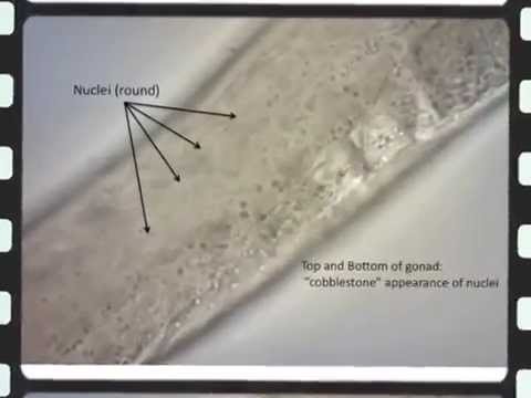 Still image from the Injection of <em>C. elegans</em> Gonads YouTube video
