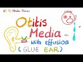 Otitis Media with effusions - Glue Ear