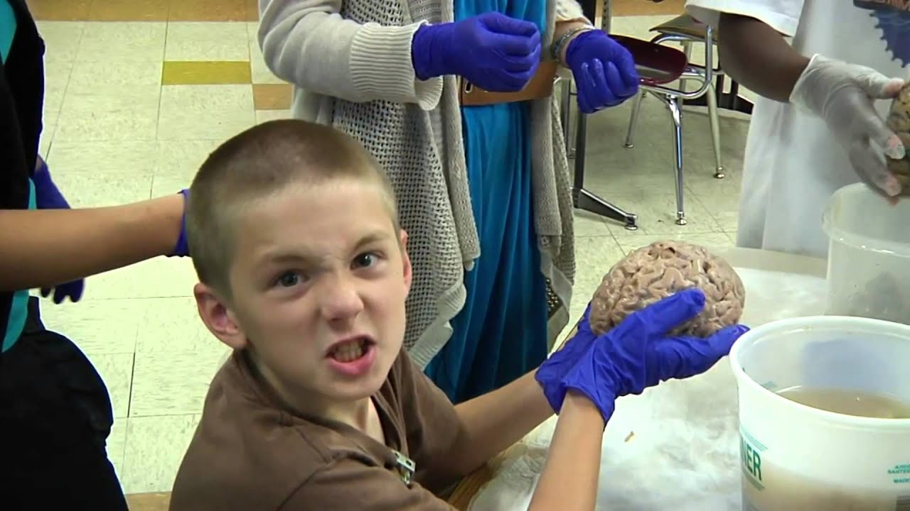 NW Noggin: 2014 Neuroscience Outreach