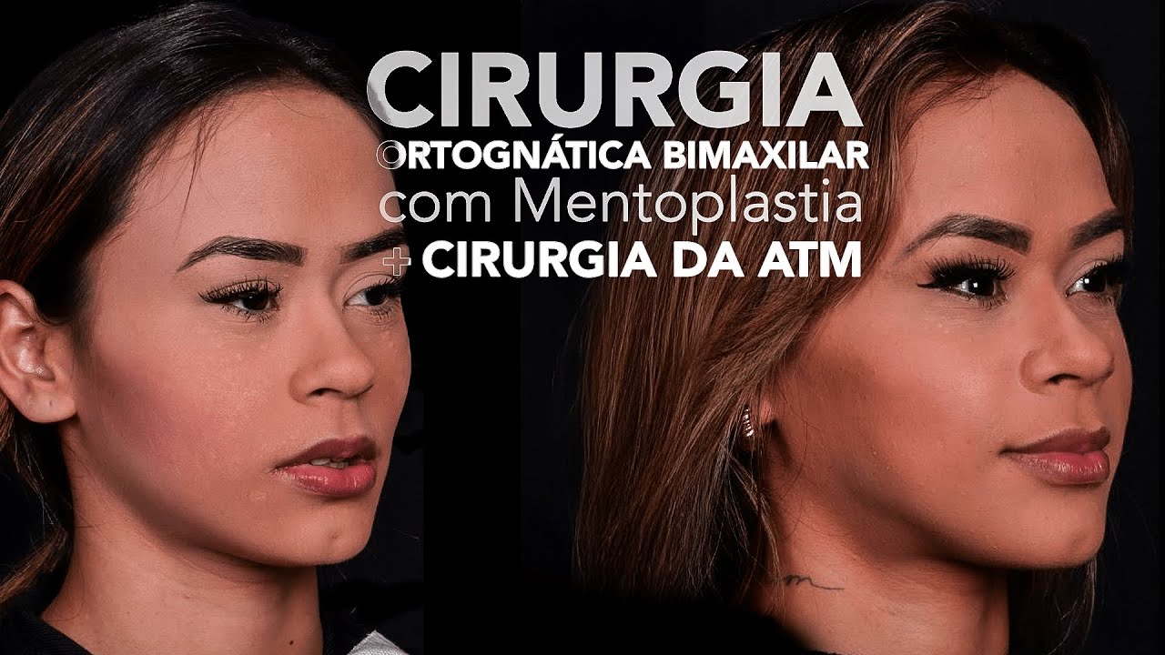 João Pedro Paulino Mazzon-81